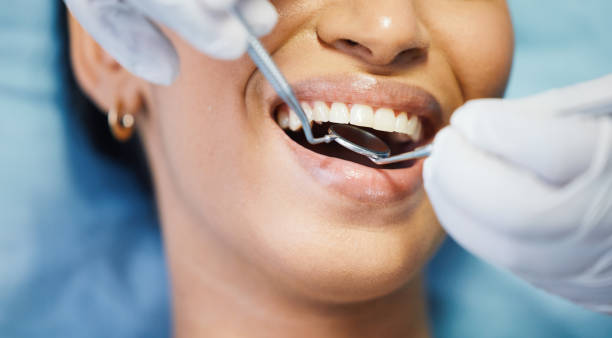 Emergency Dental Services in North Baltimore, OH